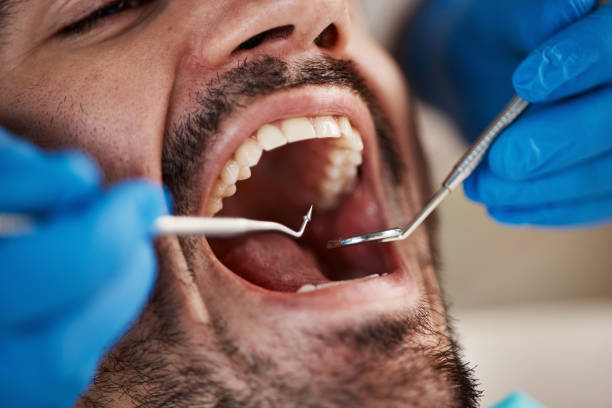 Best Emergency Dental Extractions in Camp Wood, TX