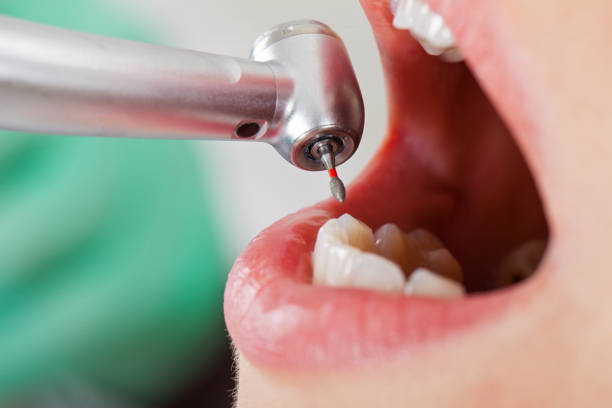 Best Broken or Cracked Tooth Emergency Dentist in Camp Wood, TX